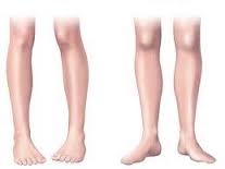 Podolog�a Infantil